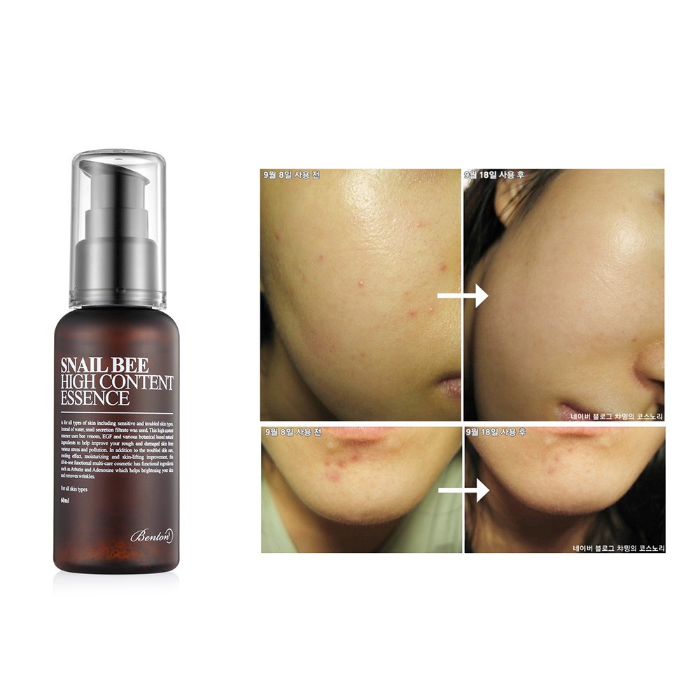 039697aefc2db28396a2017d1abb5f32