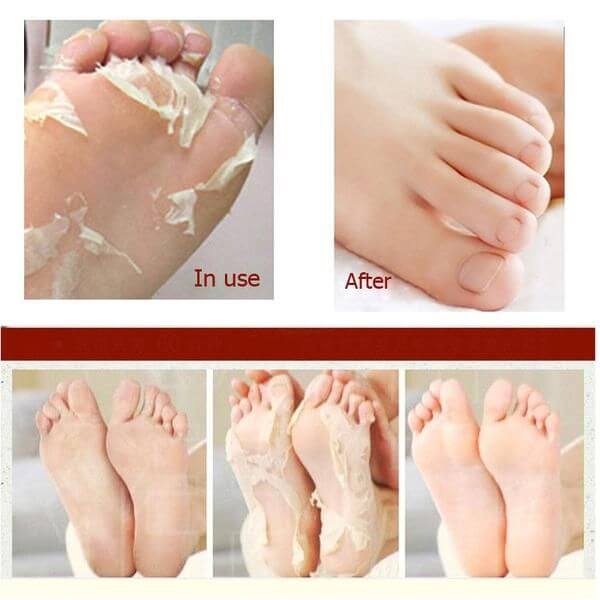 apieu_soft_foot_peeling_socks_bbmania_1